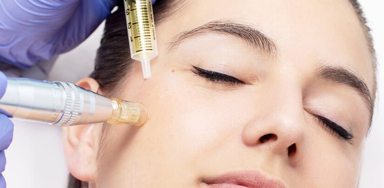 Mesotherapy